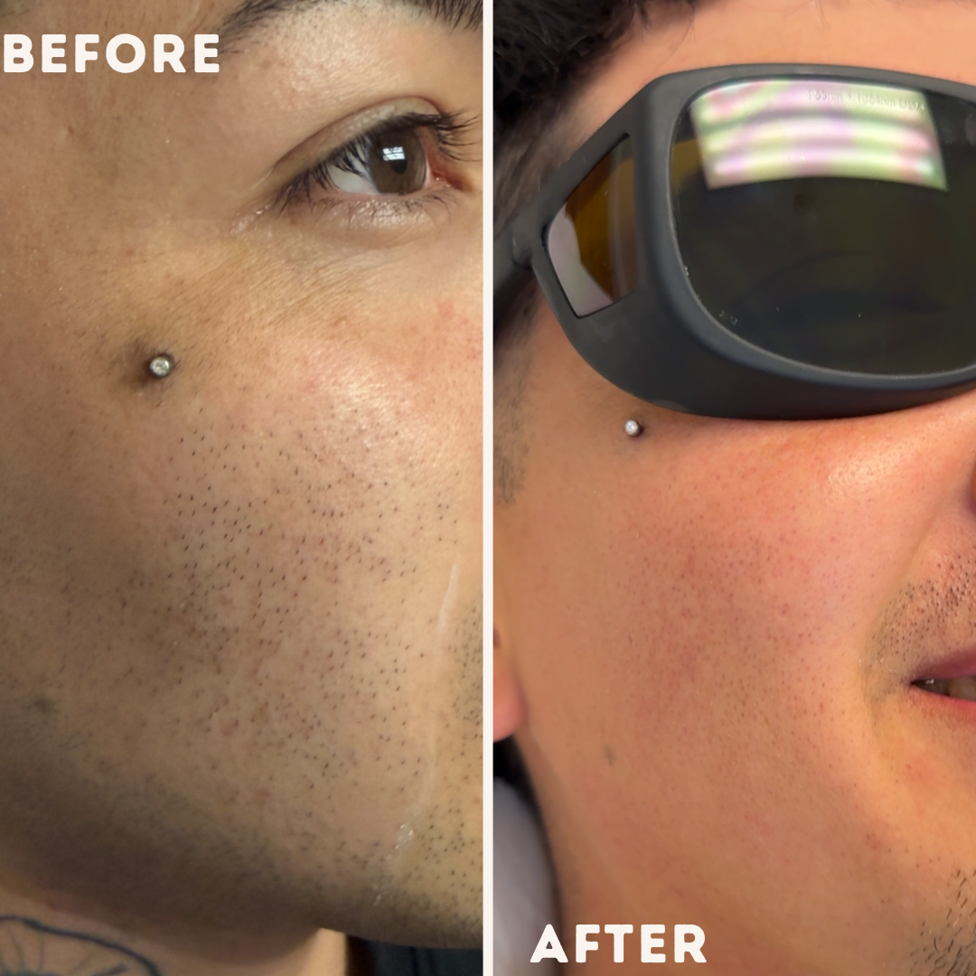 Before and after treatment